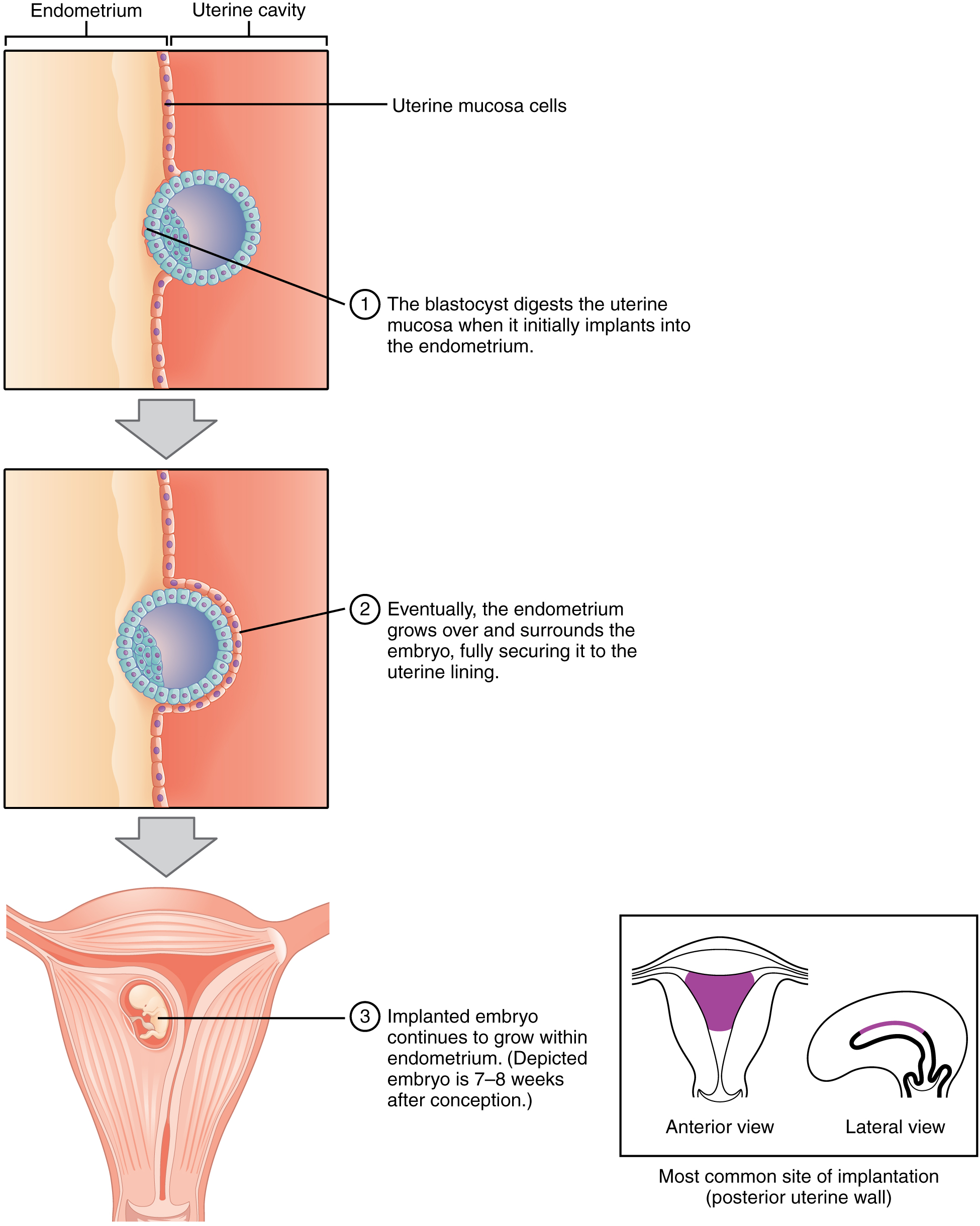 Featured image of post When Does Implantation Begin As The Fourth Step Of The Nursing Process